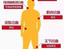 血友病的症状,揭秘罕见遗传性出血疾病的症状与挑战